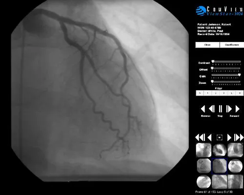 ComView's Technology Brings Flexibility, Communication to Cardiologists